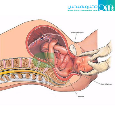 آیا اضافه وزن در بارداری خطرناک است