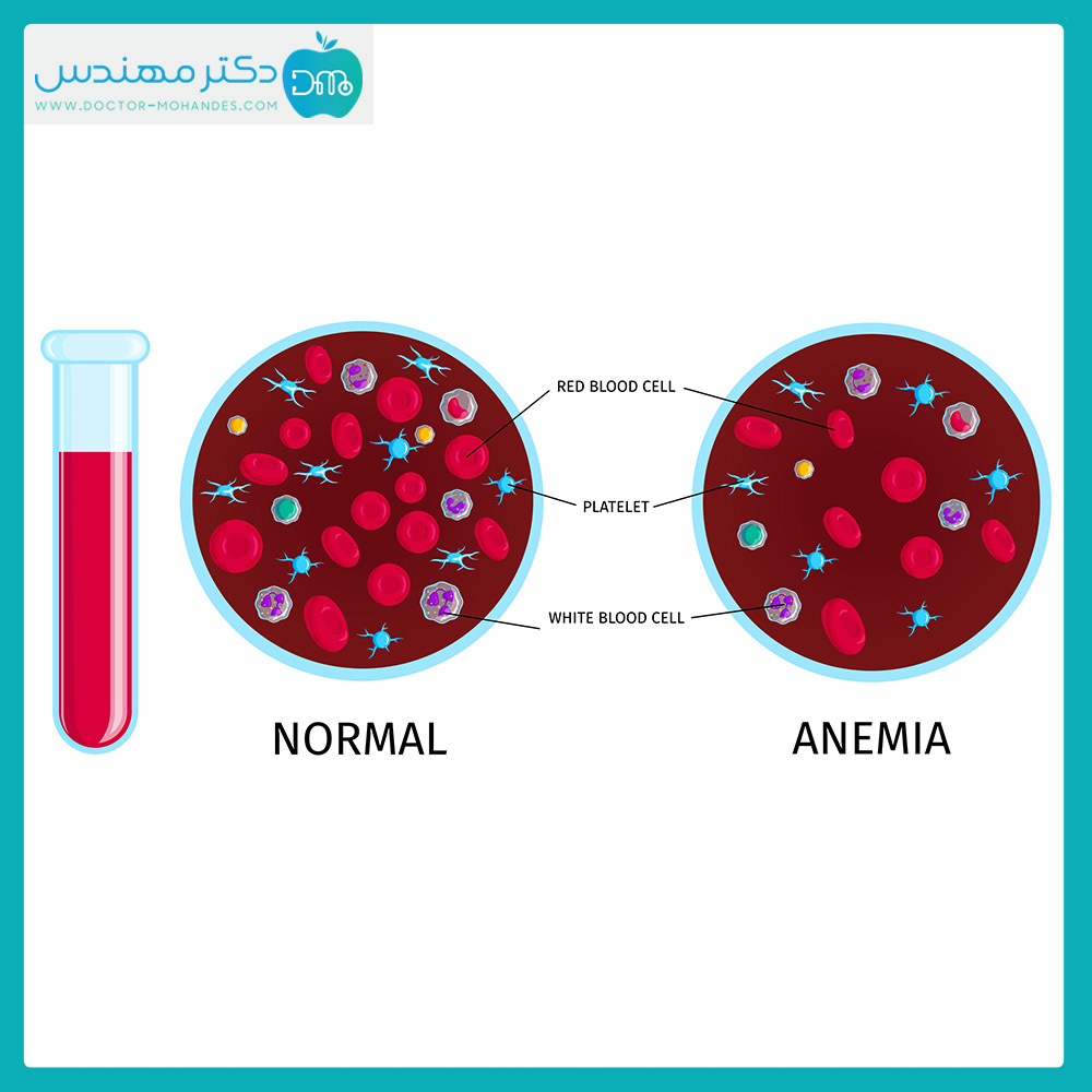 anemia07.jpg