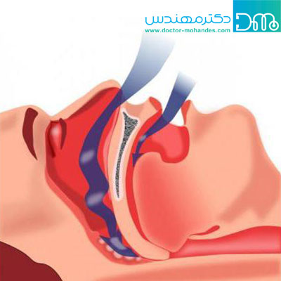 علت ریزش آب دهان هنگام خواب چیست؟