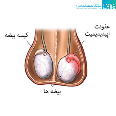 علت درد بیضه چپ