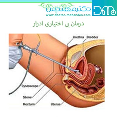 درمان بی اختیاری ادرار