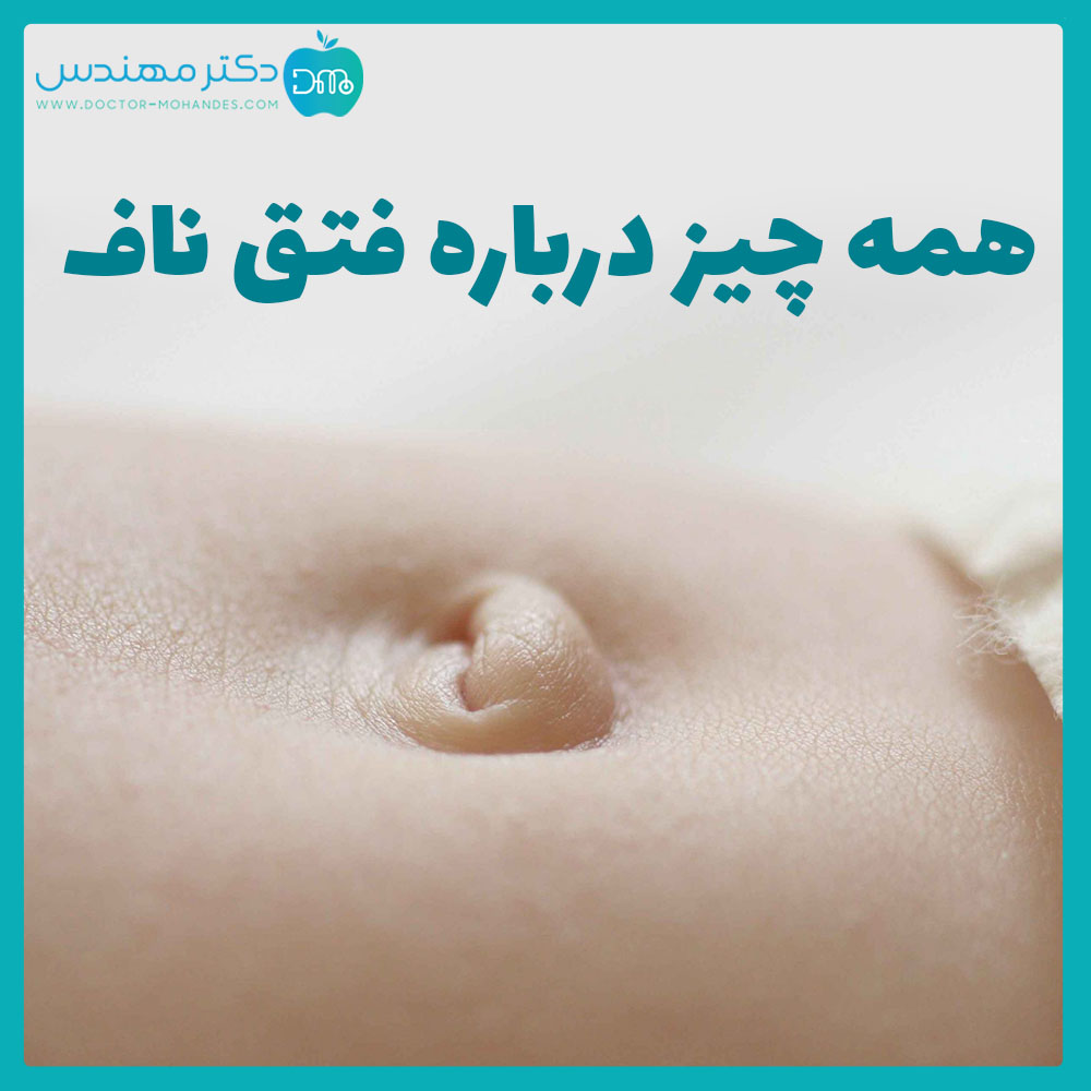 همه چیز درباره فتق ناف