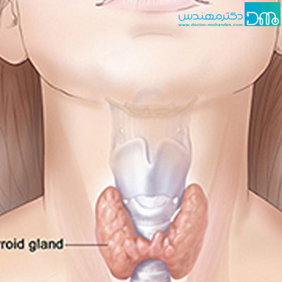 kamkari tiroid