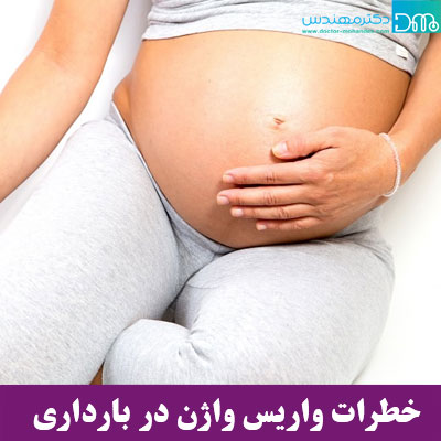 خطرات واریس واژن در بارداری