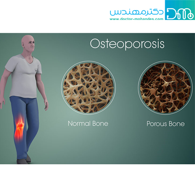 مضرات گیاهخواری برای سلامتی