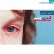 درمان فوری قرمزی چشم