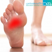 درمان درد زیر پنجه پا