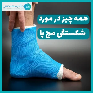  شکستگی مچ پا