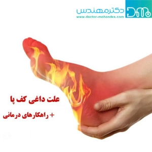 علت سوزش و داغی کف پا 