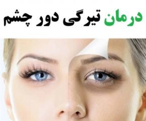 معجزه ای برای تیرگی دور چشم