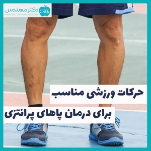 حرکات ورزشی مناسب برای درمان پاهای پرانتزی