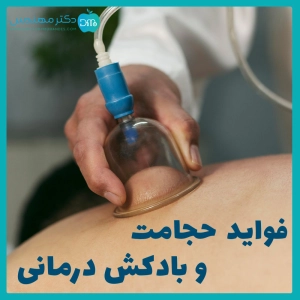 آثار و فواید حجامت