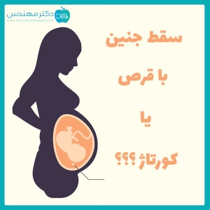 سقط جنین با قرص یا کورتاژ؟