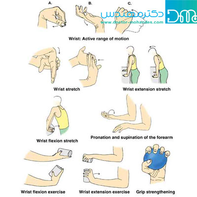 ورزشهای مفید در پیشگیری و درمان درد مچ دست